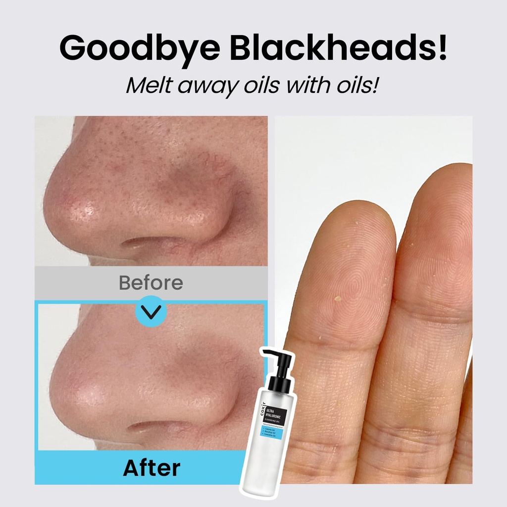 Coxir-UltraHyaluronicCleansingOil-150ml_4