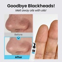 Coxir-UltraHyaluronicCleansingOil-150ml_4