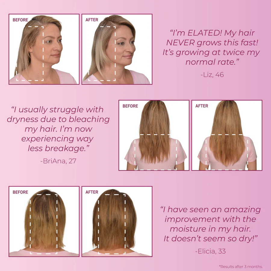 Bosley-MendXtend-Strenghthening-Shampoo-300ml_2